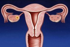 <b>子宫颈短小是否影响美国的试管婴儿？</b>