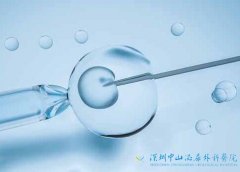 深圳哪里可以助孕龙凤胎-试管婴儿的具体步骤和时间是什么？